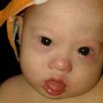 [CAMPAGNE] Déjà 218 000 $ récoltés pour Gammy, un bébé trisomique laissé à sa mère porteuse